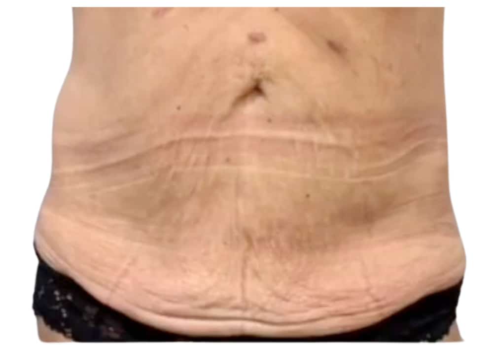 abdominale-before-1