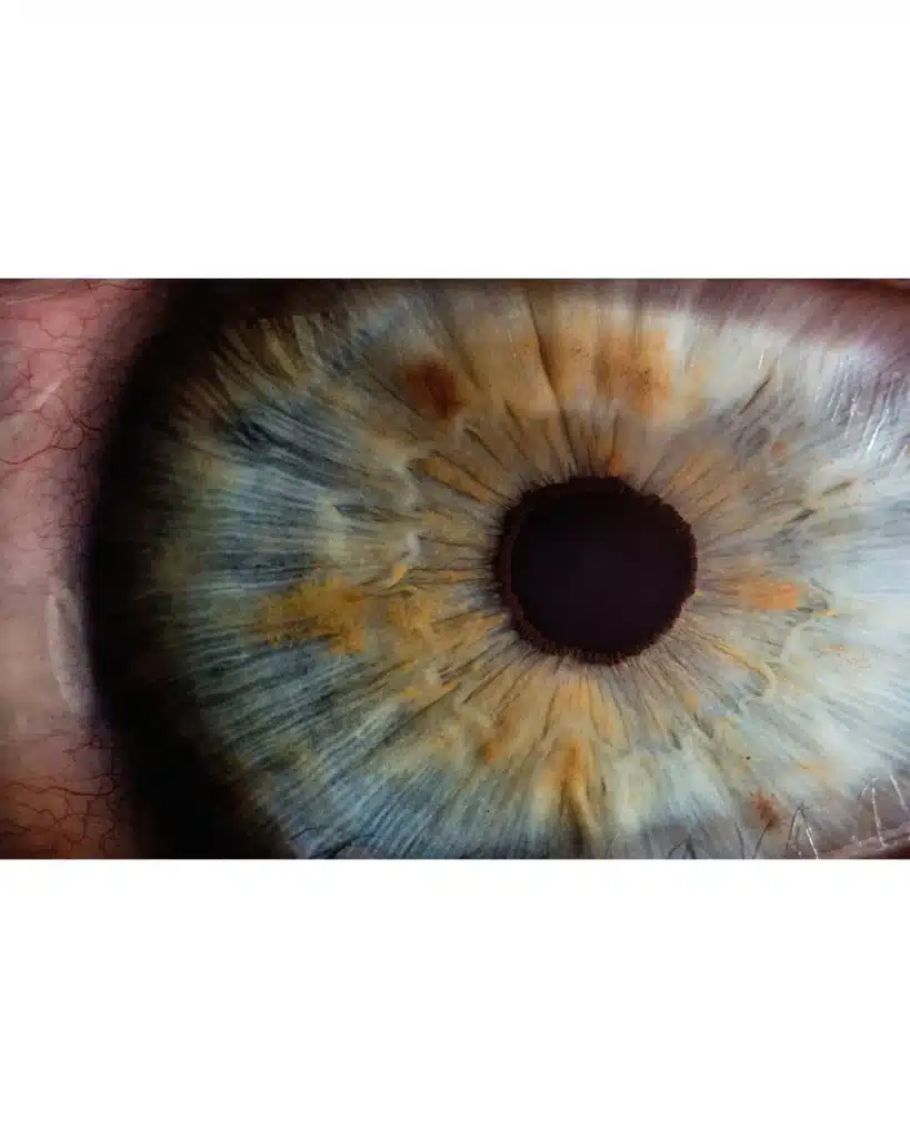 IRIS DE L OEIL